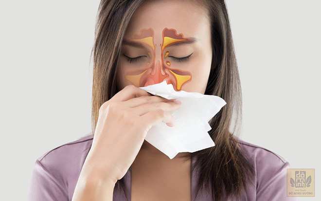 Bệnh viêm mũi xuất tiết là gì? Cách chữa trị hiệu quả từ thảo dược tự nhiên