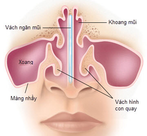 Cách điều trị viêm mũi vận mạch