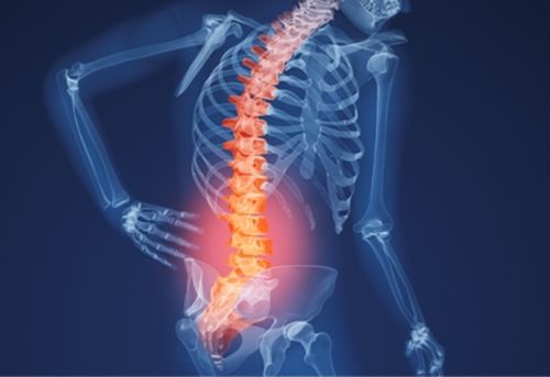 Cách giảm đau cho người bệnh bị thoái hóa cột sống thắt lưng
