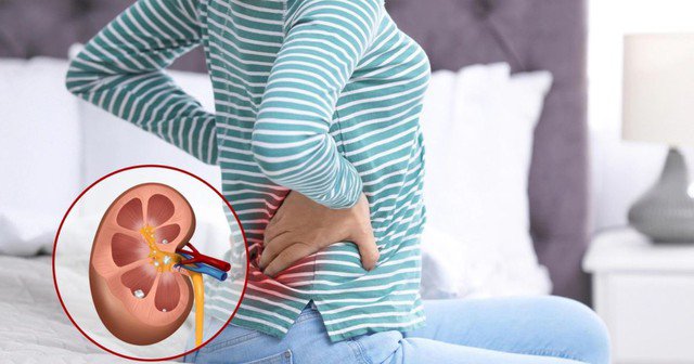 Dấu hiệu cảnh báo suy thận người Việt không nên bỏ qua