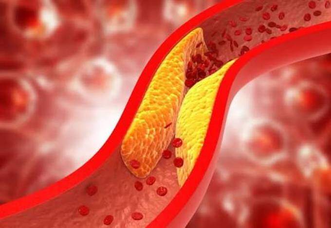 9 thói quen giúp bảo vệ mạch máu
