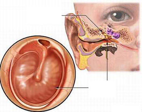 Cách chữa trị mủ trong tai